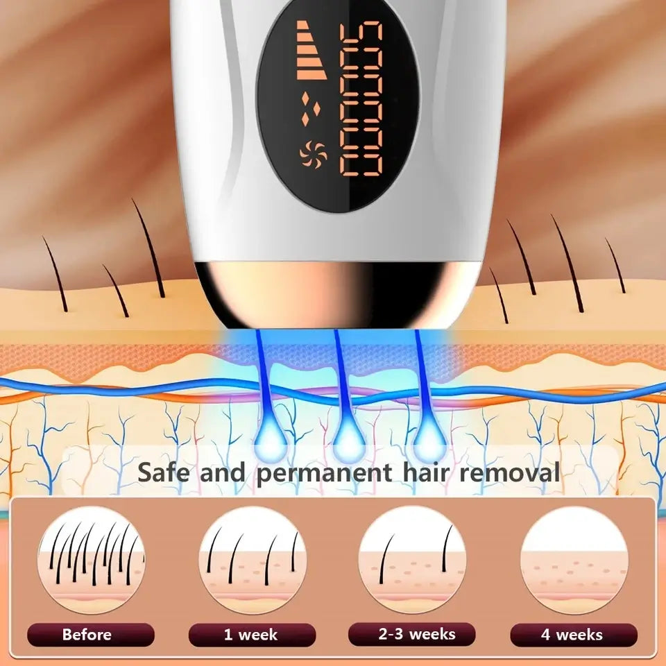 laser hair removal machine